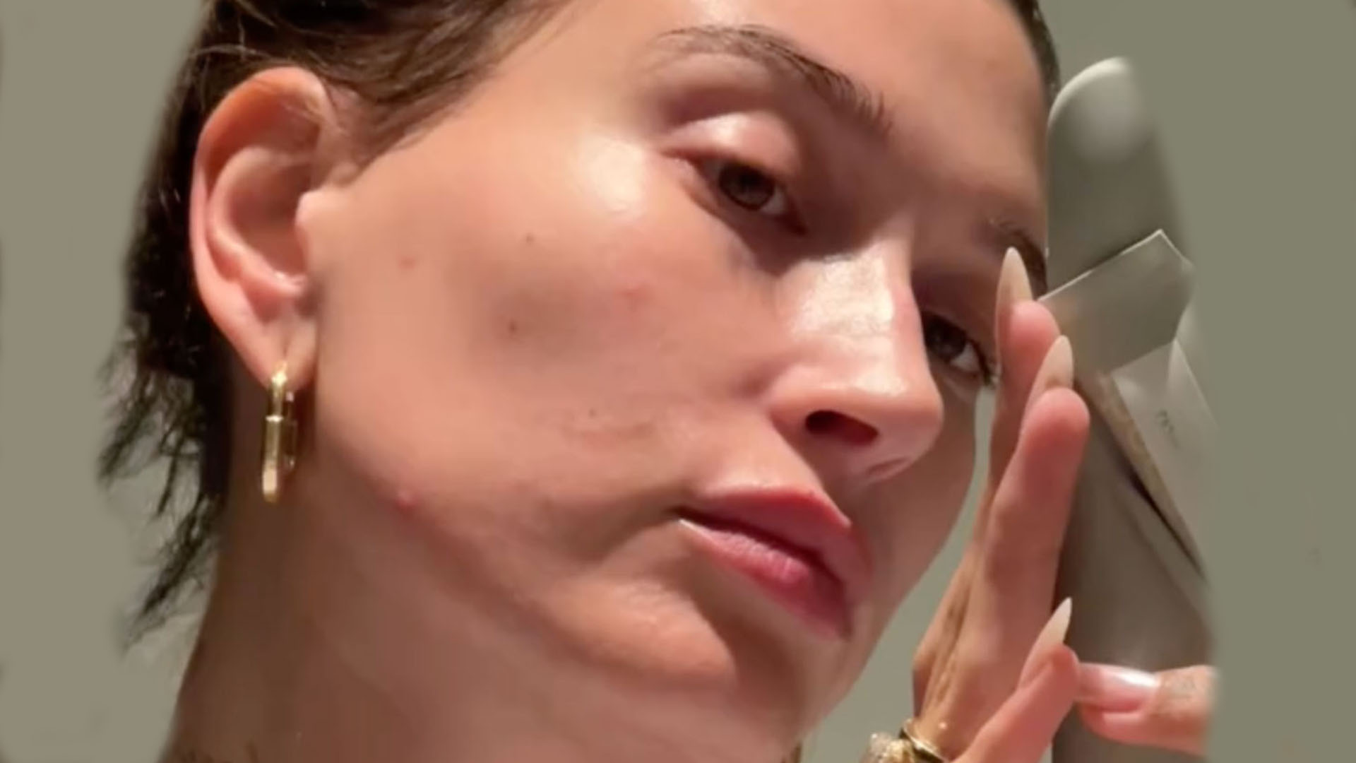 Hailey Bieber reveals ‘bad flare-up’ of skin disorder with ‘tiny red bumps’ on her face in unedited video at home