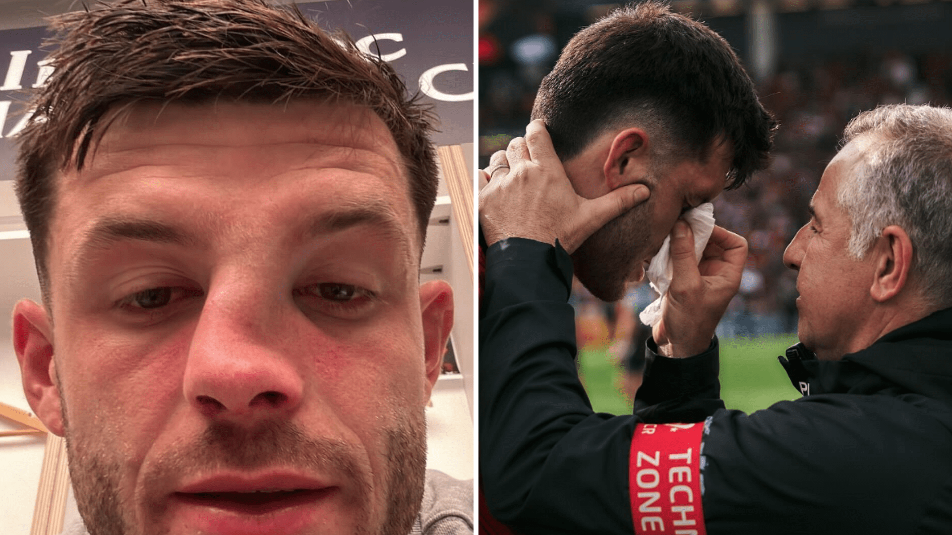 Scotland rugby star shares gruesome images of horror facial injury that stopped him from celebrating dramatic win [Video]