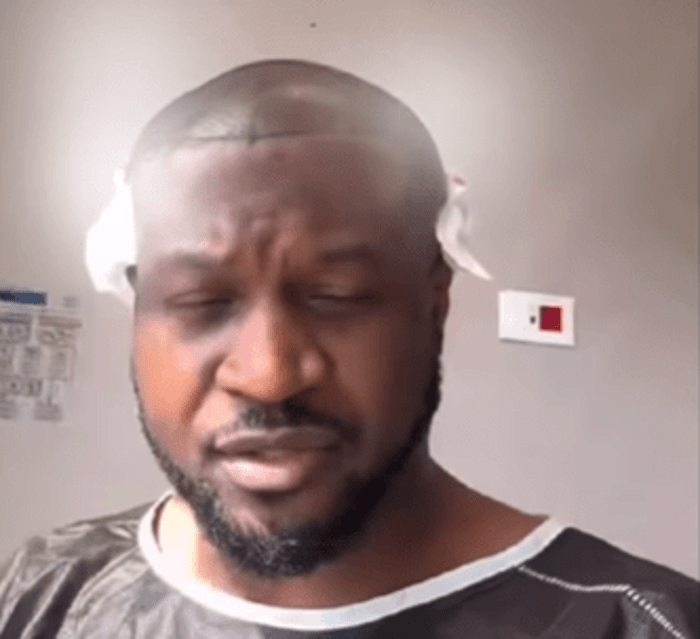 P Squares Peter Okoye gets a hair implant [Video]