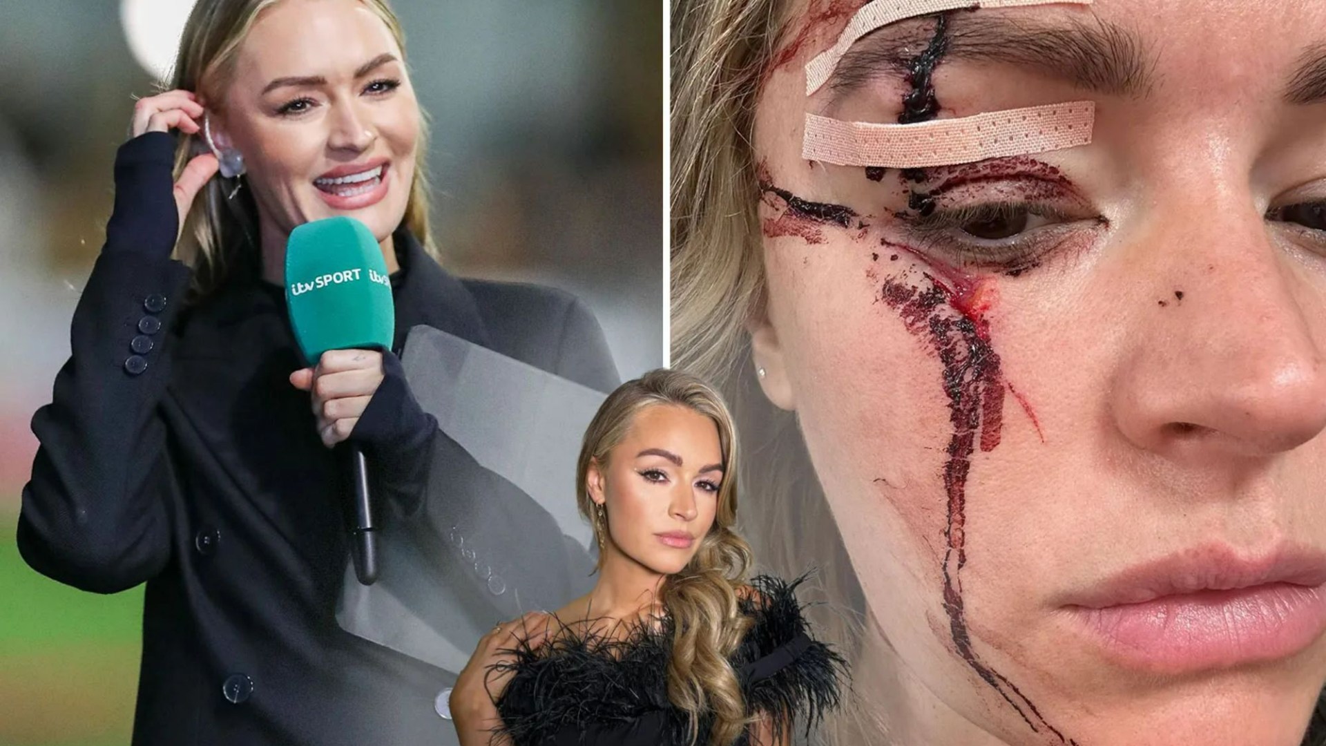 Laura Woods’ return to TV confirmed as pundit’s first job since needing surgery for freak accident is announced [Video]